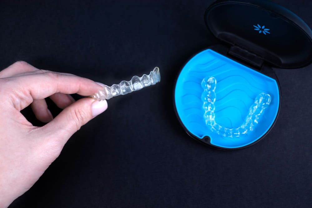 How to Clean Invisalign: Expert Tips for Maintaining Clear Aligners