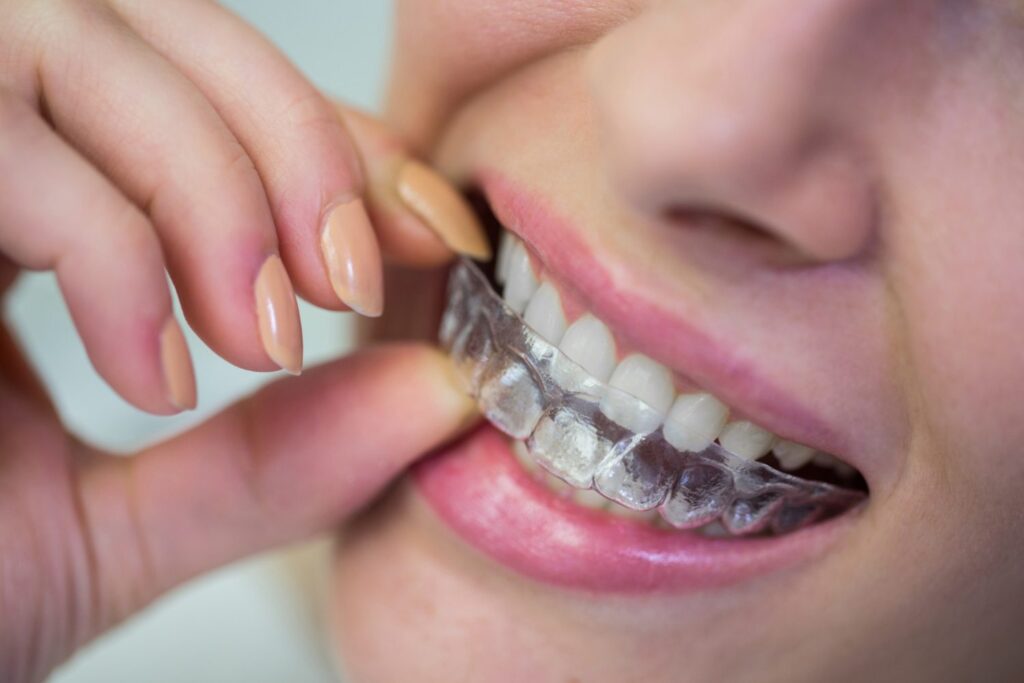 Does Wearing Invisalign® Invisible Braces Hurt? - Palm Beach